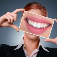 Ricostruzione dei denti: non solo un fatto estetico