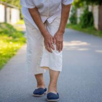 Ecco i rimedi per le vene varicose: per gli anziani fondamentale passeggiare e mantenersi attivi