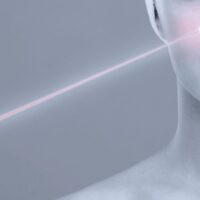 Utilizzi della Laseristica in Dermatologia e in Estetica