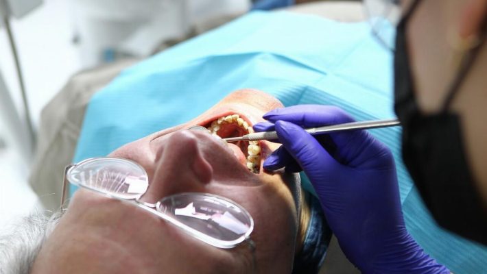 Igiene dentale GBT: pulizia professionale 4.0 che rispetta denti e gengive